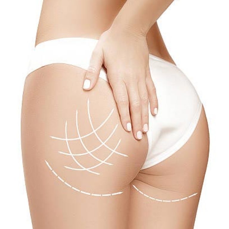 Body Firmness Milan: Youthful Tone & Lift